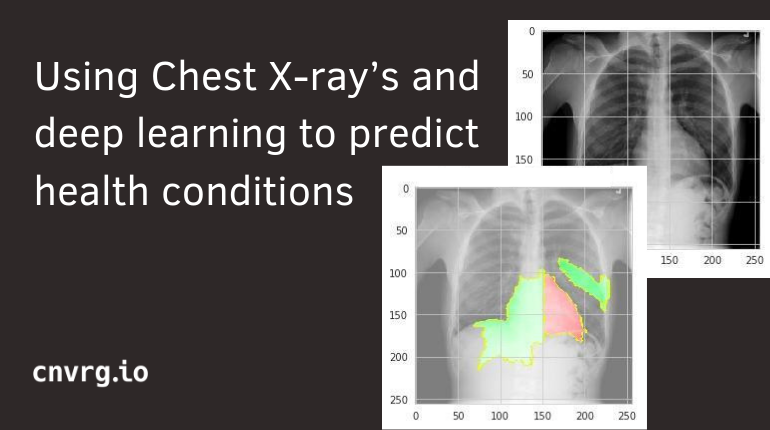 Using Chest X-ray’s And Deep Learning To Predict Health Conditions